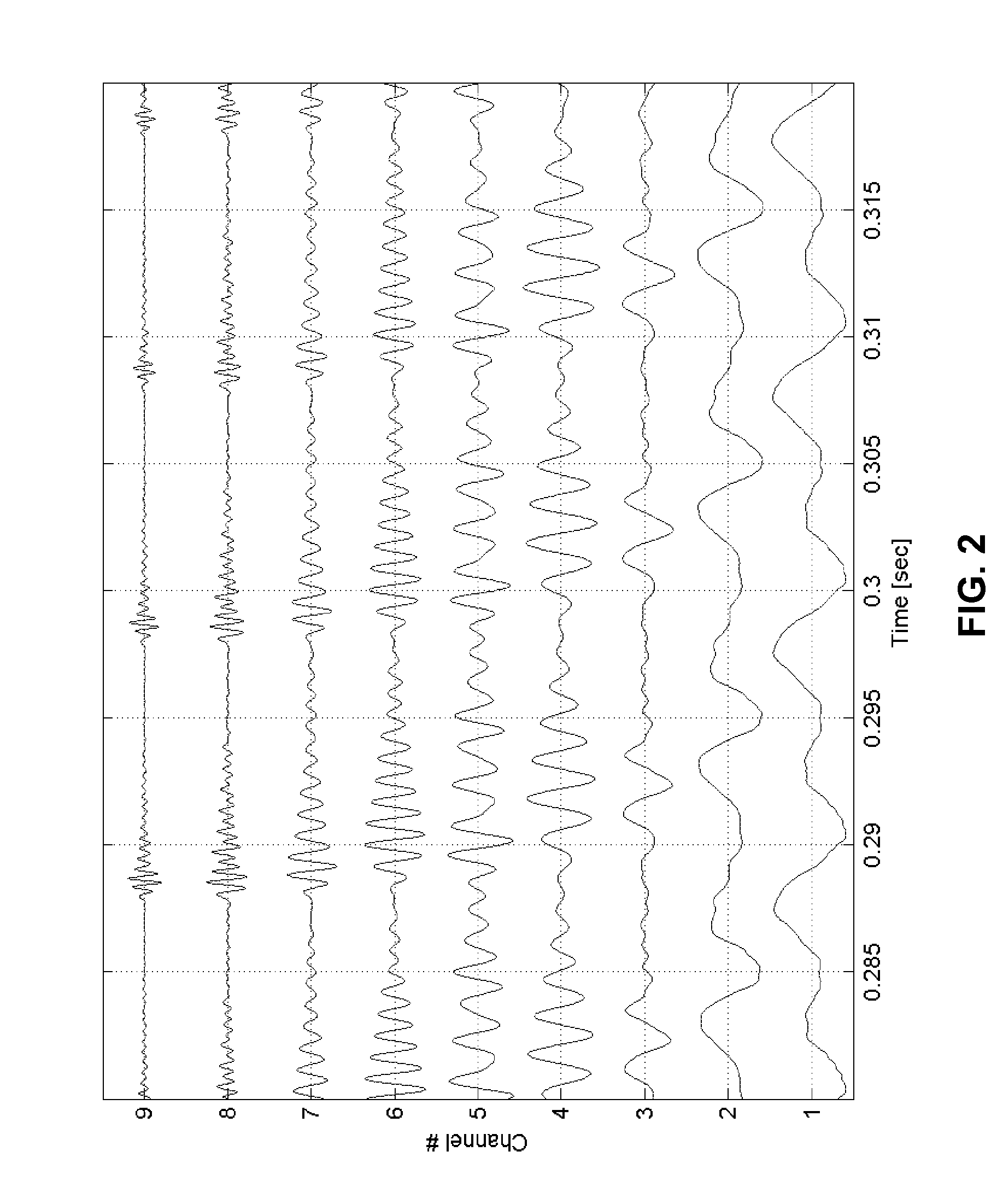 Pulsatile cochlear implant stimulation strategy