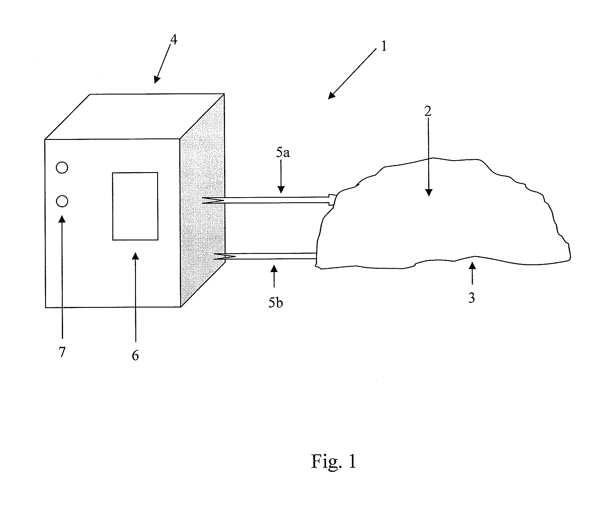 Method and apparatus for treating a wound