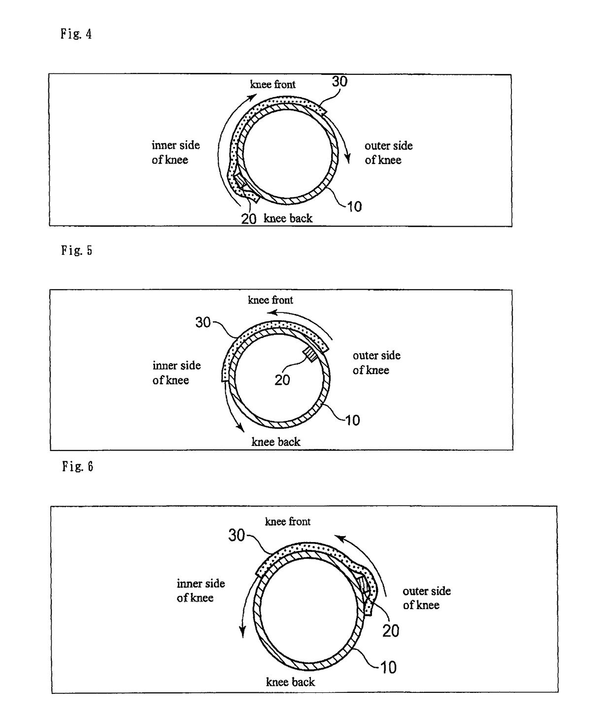 Knee support