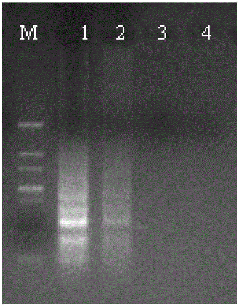 Loop-mediated isothermal amplification (LAMP) primers for rapidly detecting pratylenchus penetrans and application thereof