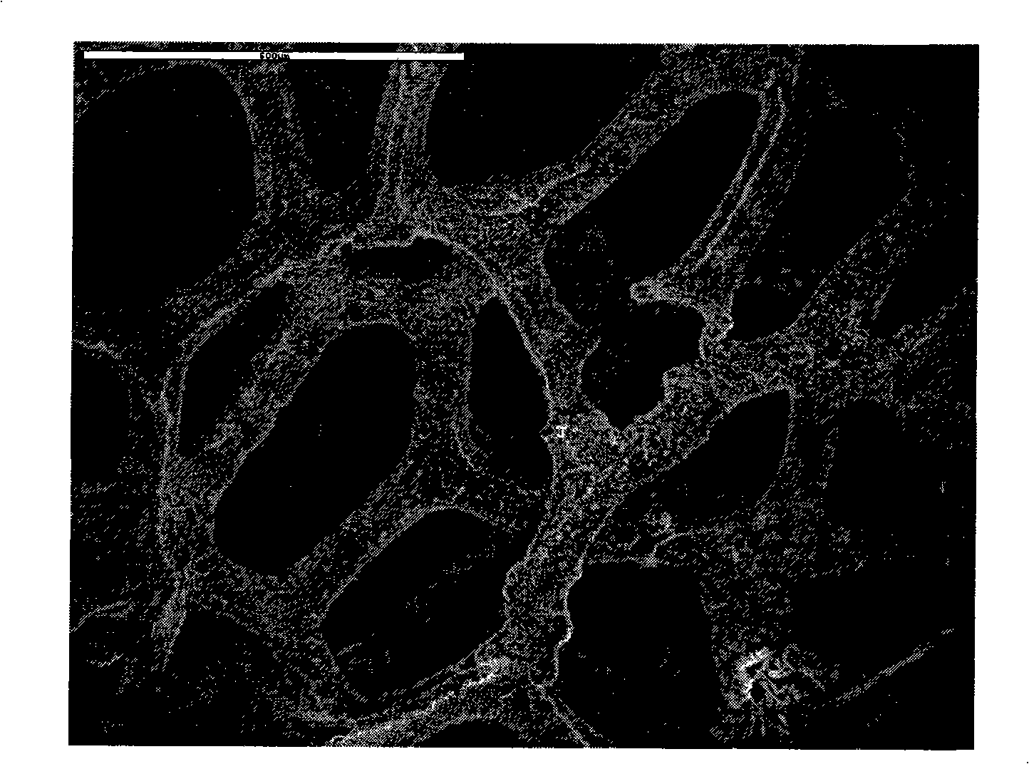 Method for preparing Pd/foamed metal catalyst for hydrogenolysis dechlorination