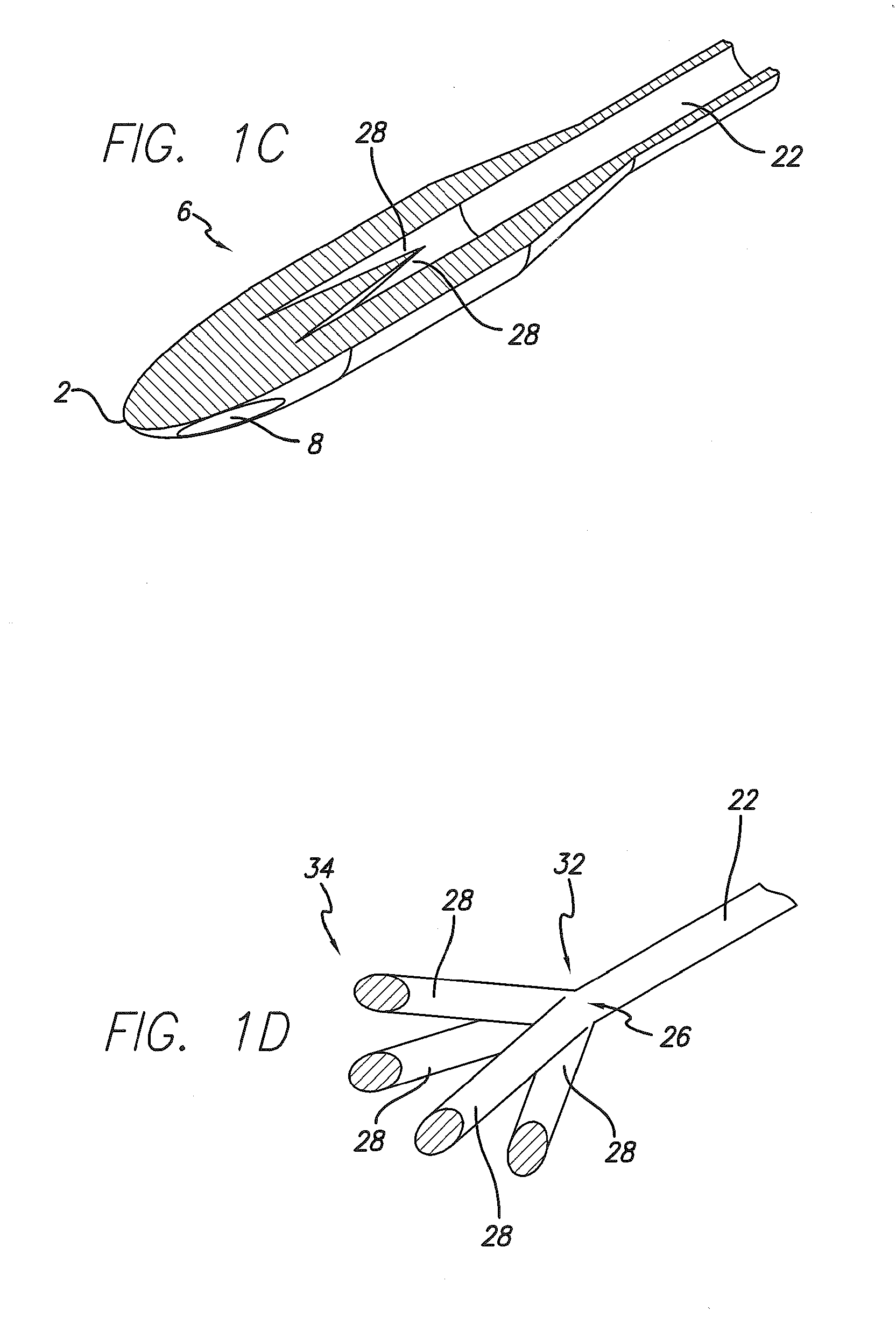 Reduction of Recirculation in Catheters