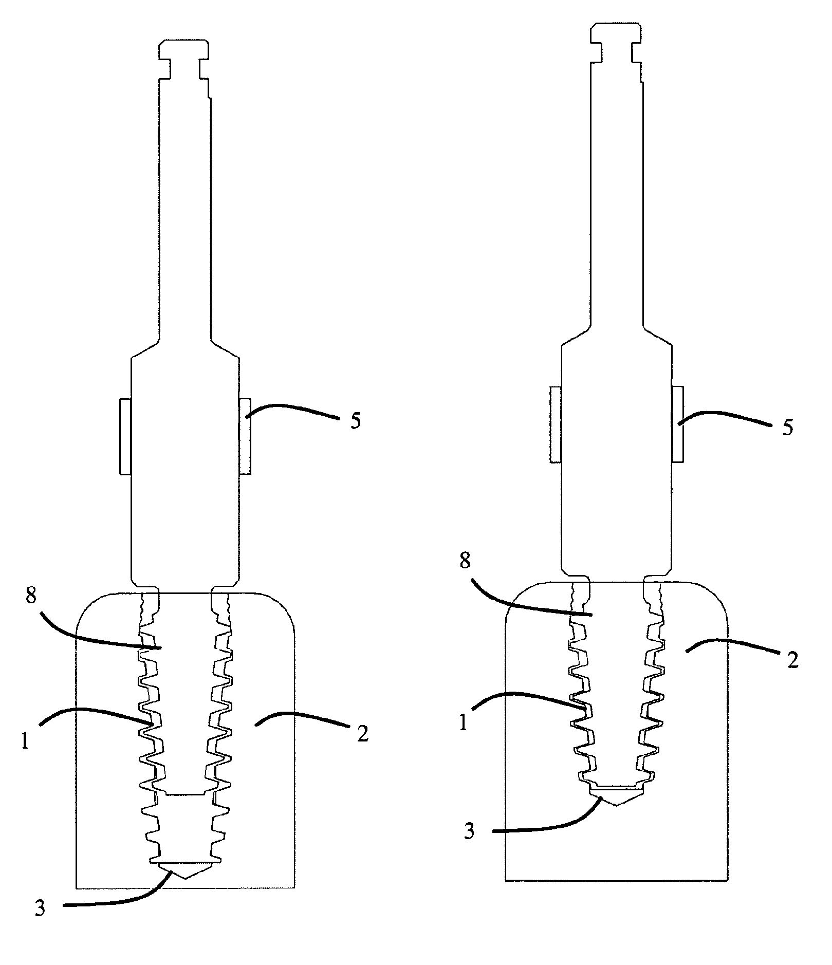 Components for threading of bone