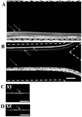 Microfluid control system for separating, focusing and sorting of rare cells and application