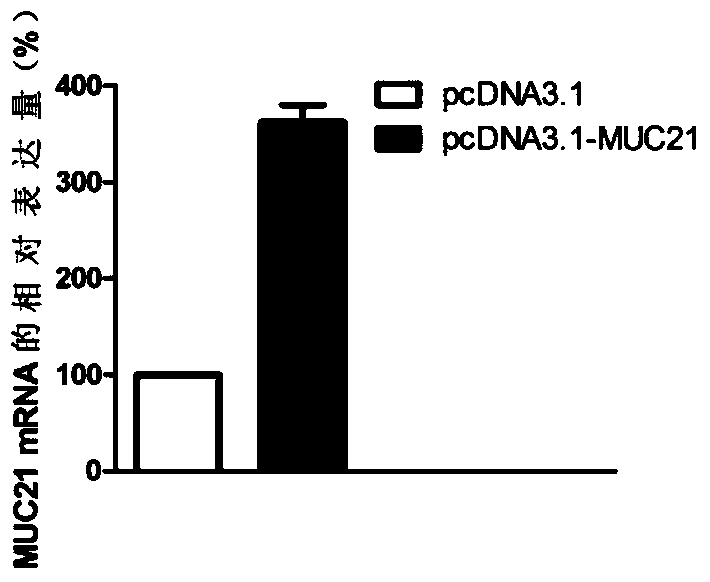 Application of muc21 gene and its expression product in diagnosis and treatment of pituitary tumor