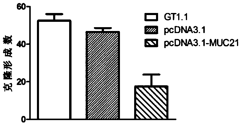 Application of muc21 gene and its expression product in diagnosis and treatment of pituitary tumor