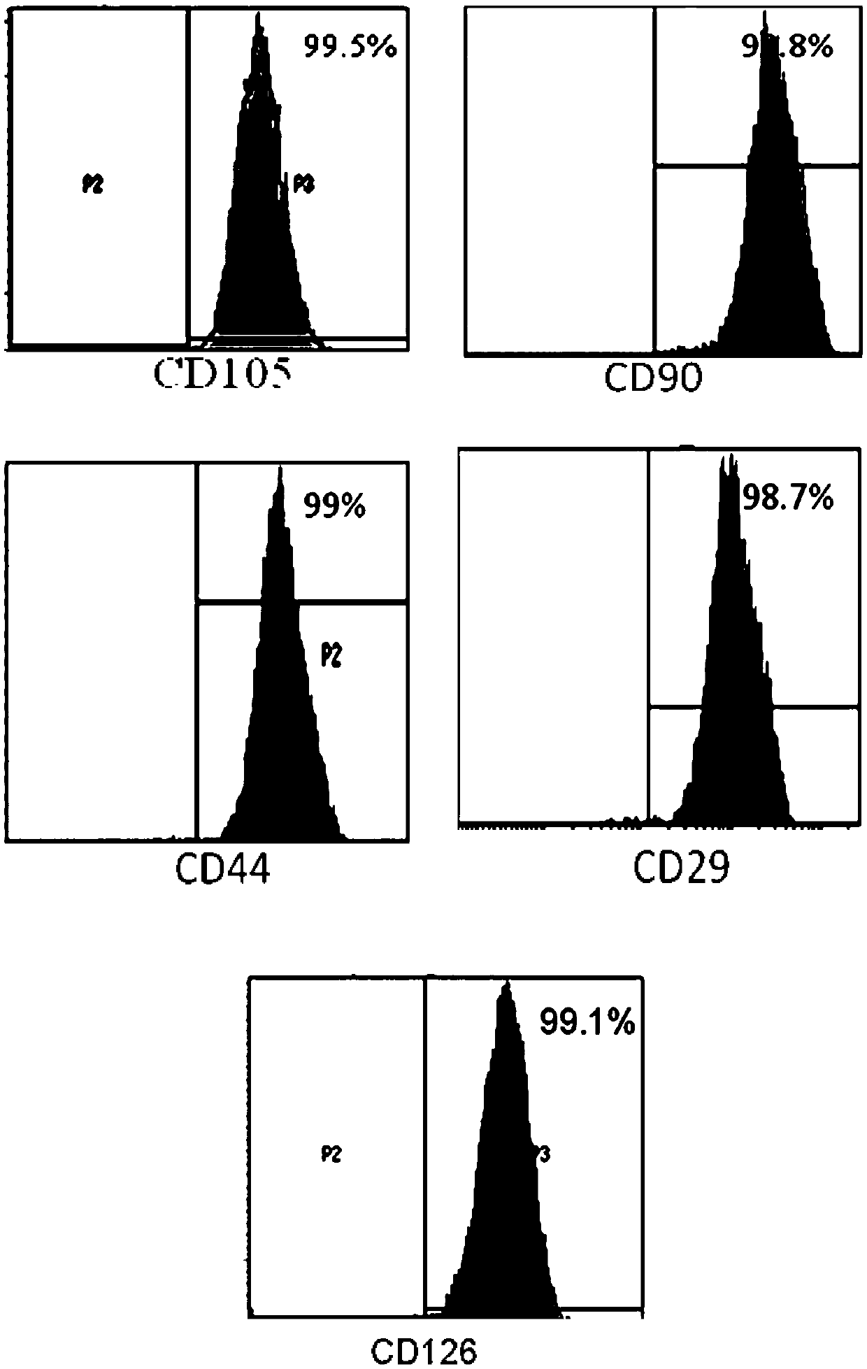 Application of mesenchymal stem cells in preparation of products for treating rheumatoid arthritis