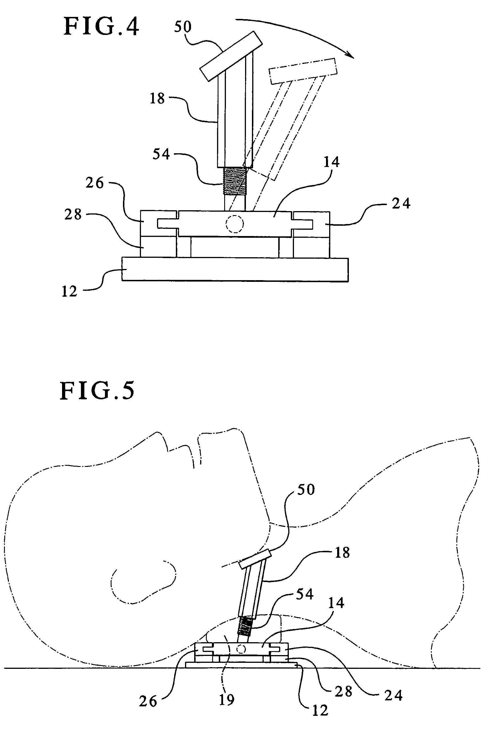 Airway management device