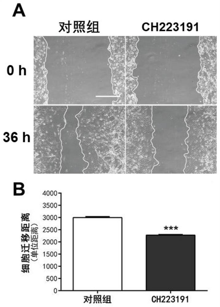 Application of CH223191 in inhibition of tumor cell migration