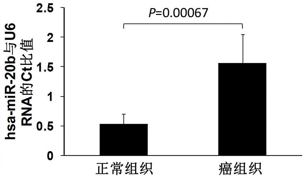 MicroRNA (micro ribonucleic acid) for regulating gene expression of PTEN (phosphatase and tensin homolog)