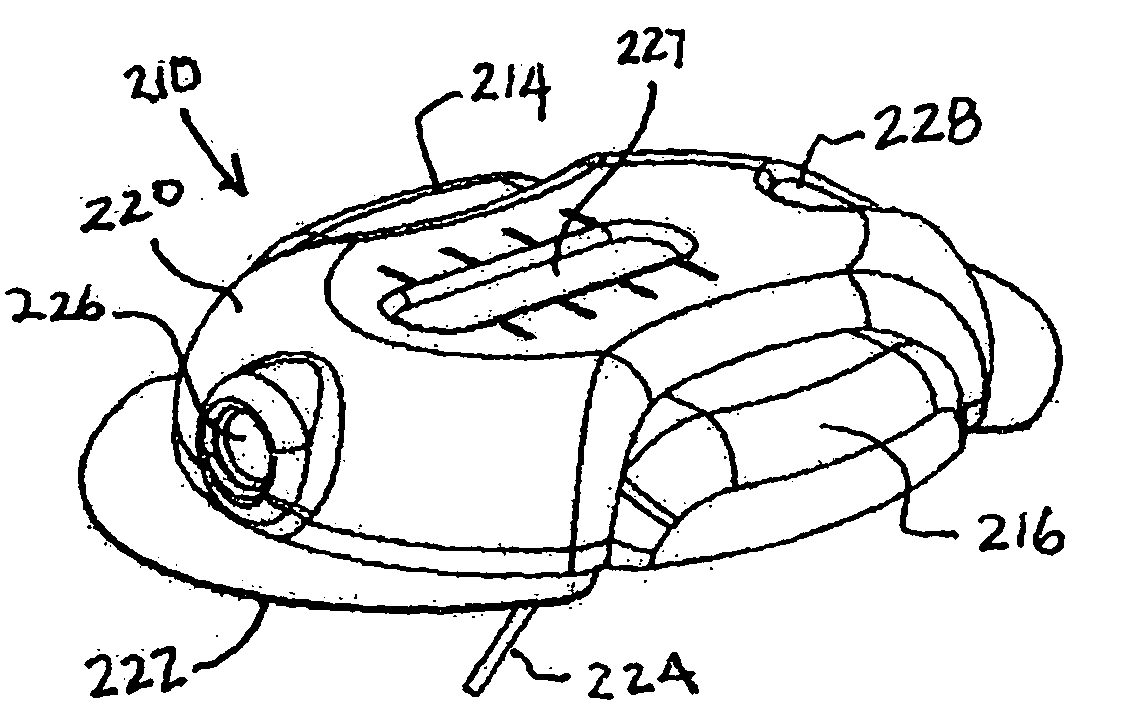 Disposable infusion device filling apparatus and method