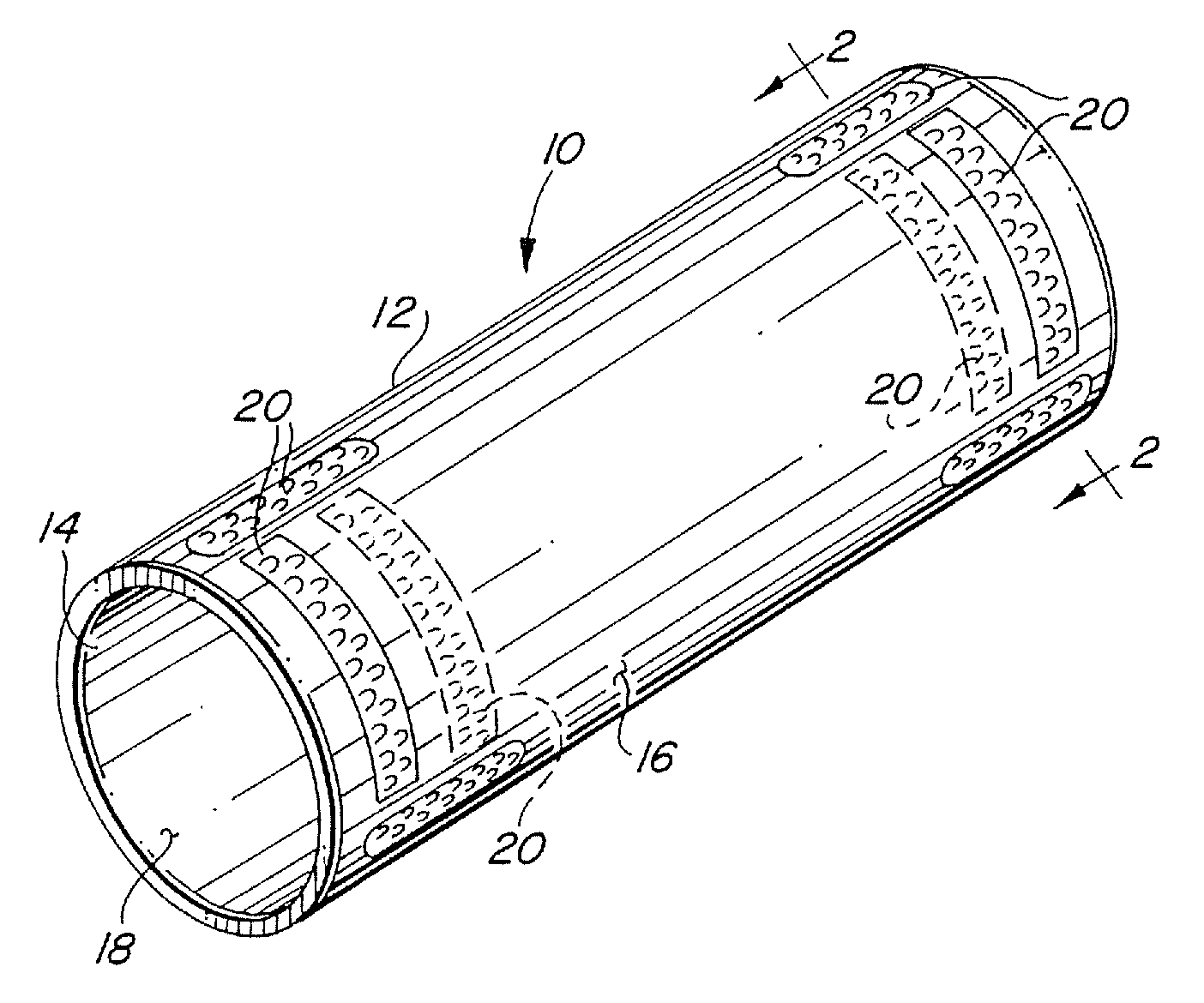 In vivo sensor and method of making same