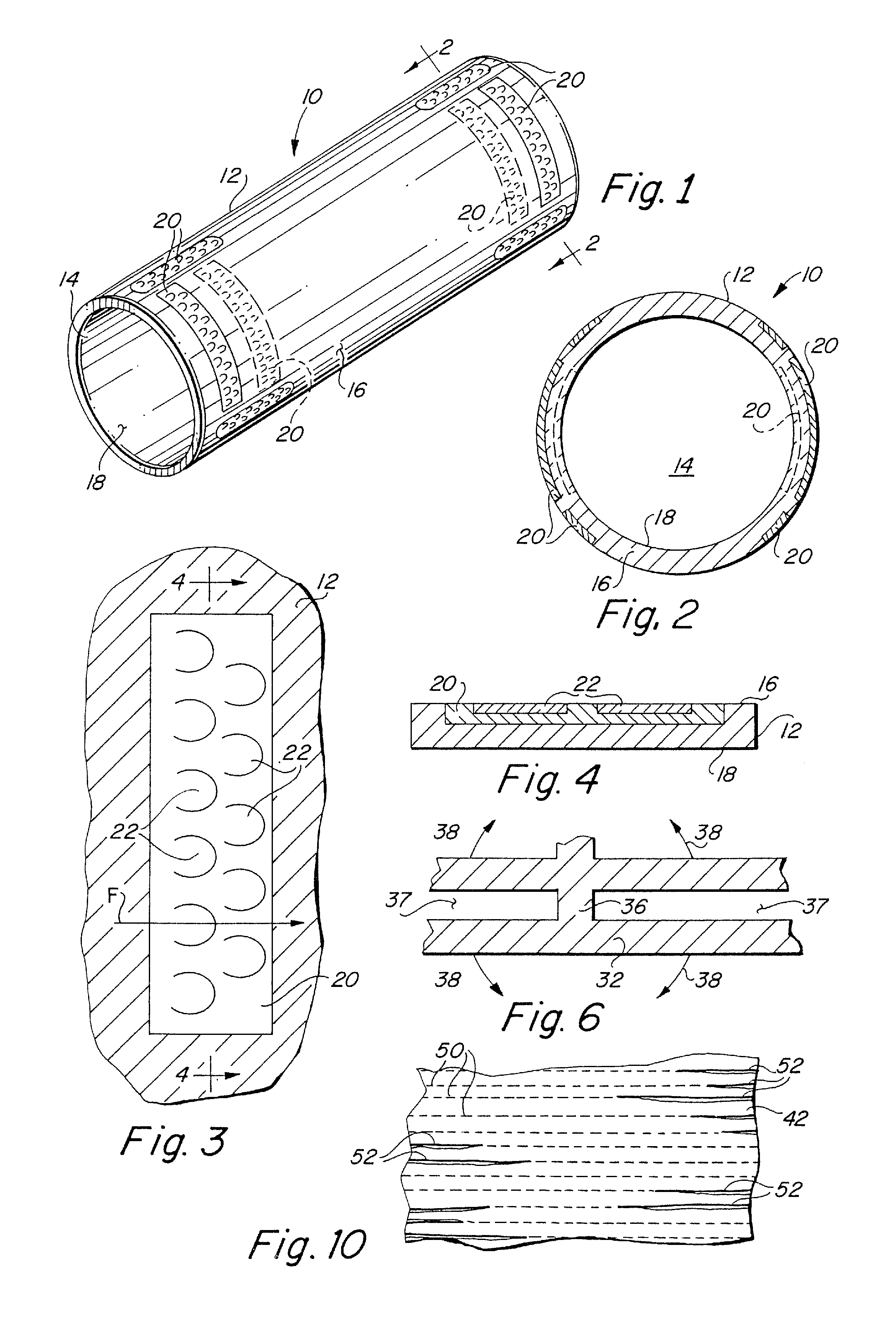 In vivo sensor and method of making same