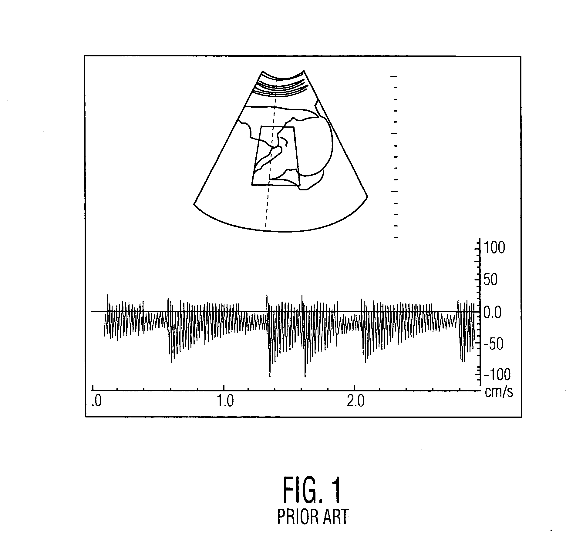 Automatic alias avoidance for doppler audio