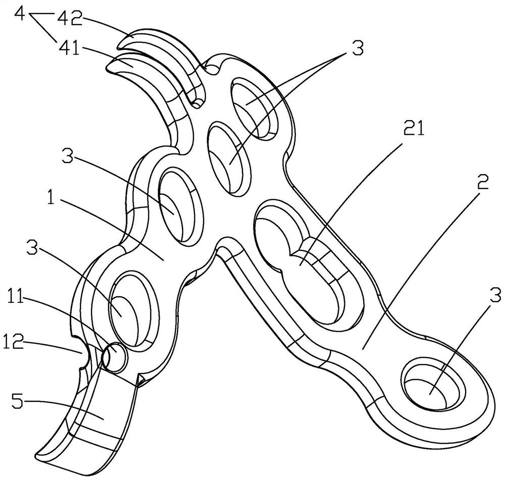 Ulna coracoid process locking plate