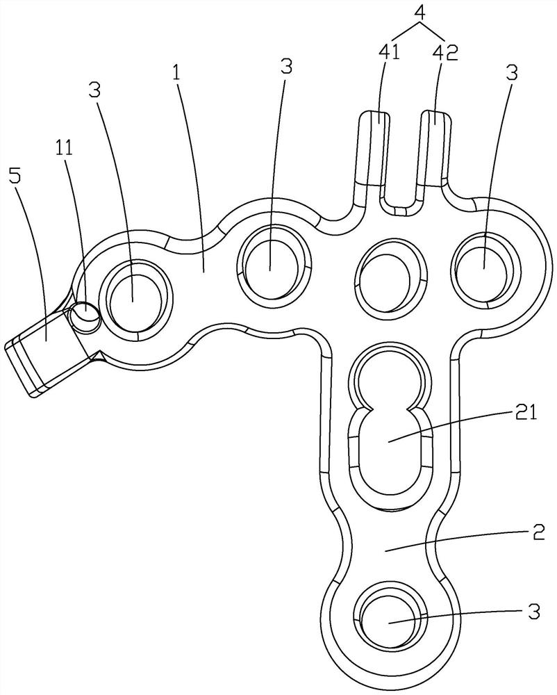 Ulna coracoid process locking plate