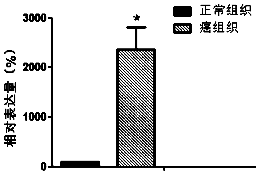 Diagnostic marker of clear cell renal cell carcinoma-c16orf74 gene