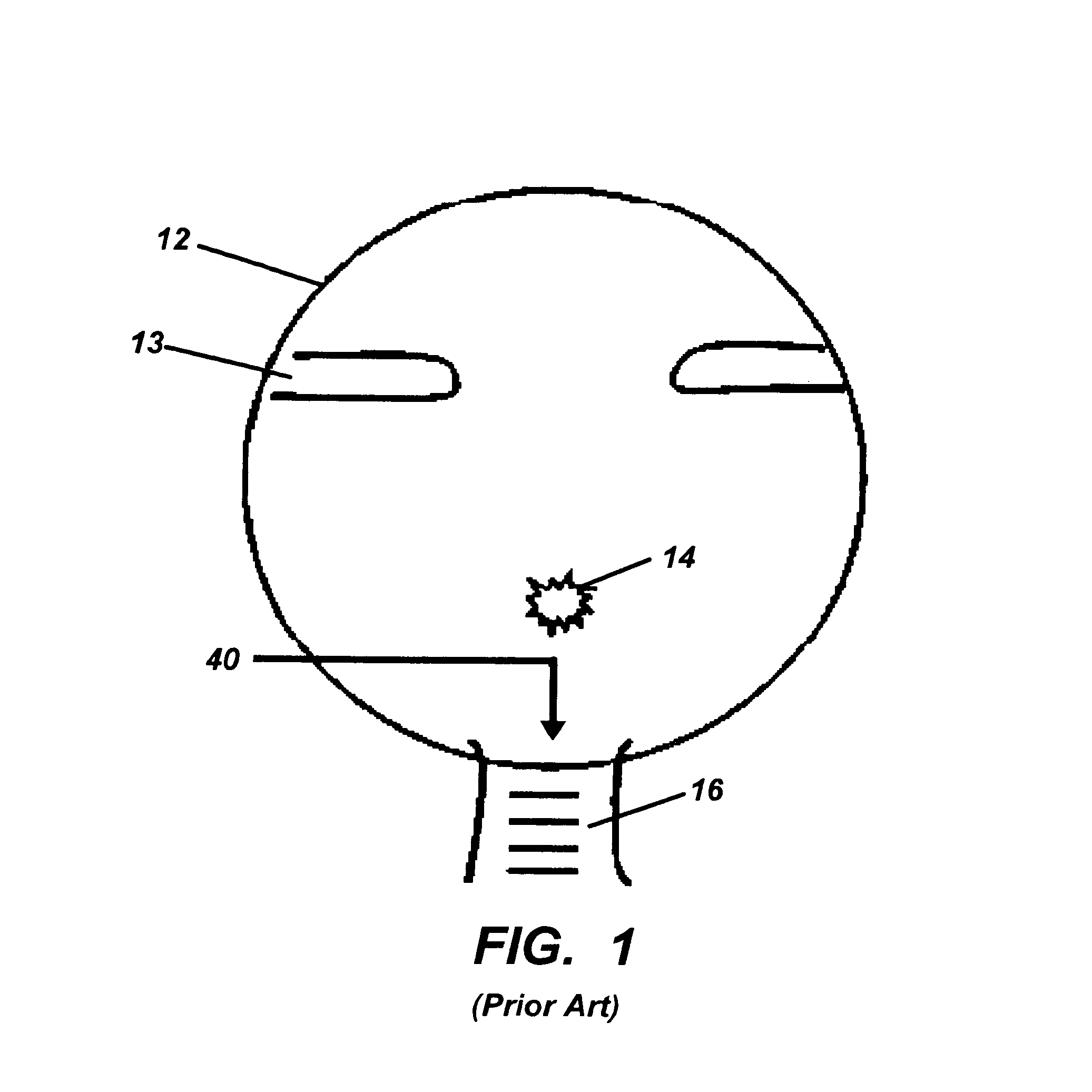 Optic nerve head implant and medication delivery system