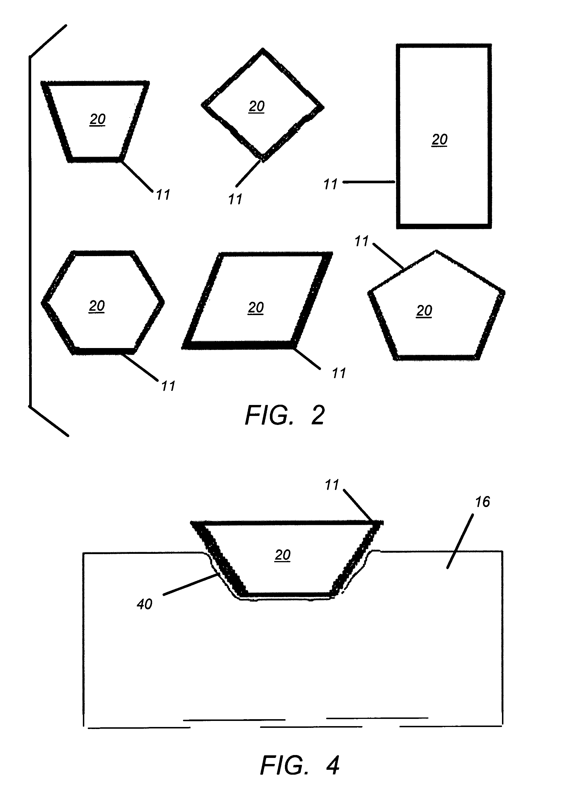 Optic nerve head implant and medication delivery system