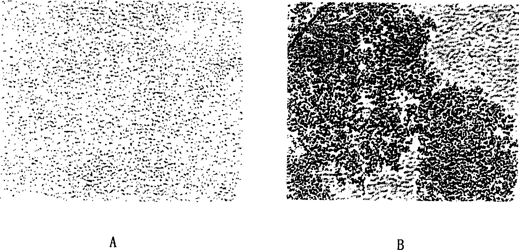 Immunization microsphere in use for detecting SARS antibody, preparation method and application