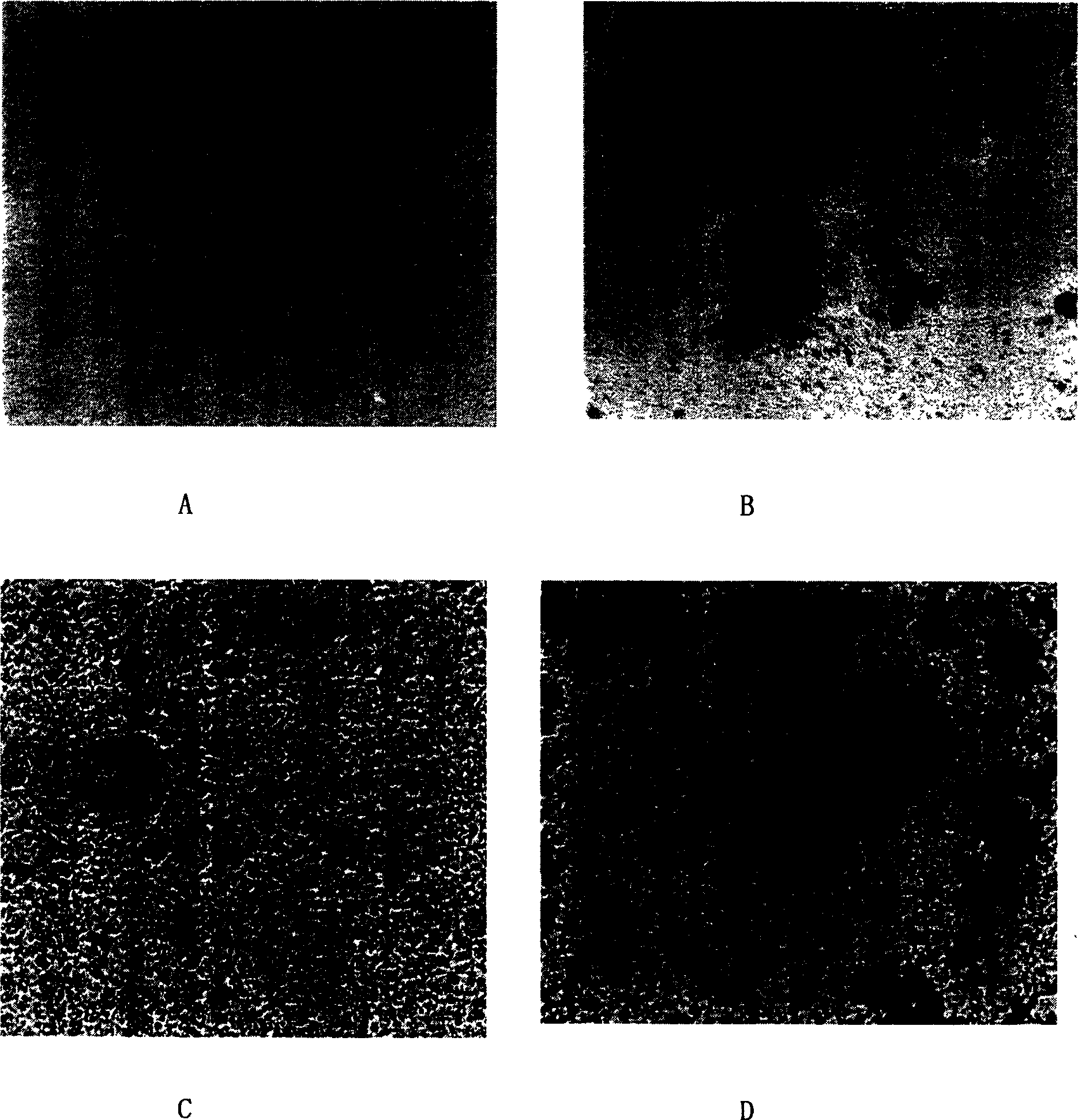 Immunization microsphere in use for detecting SARS antibody, preparation method and application