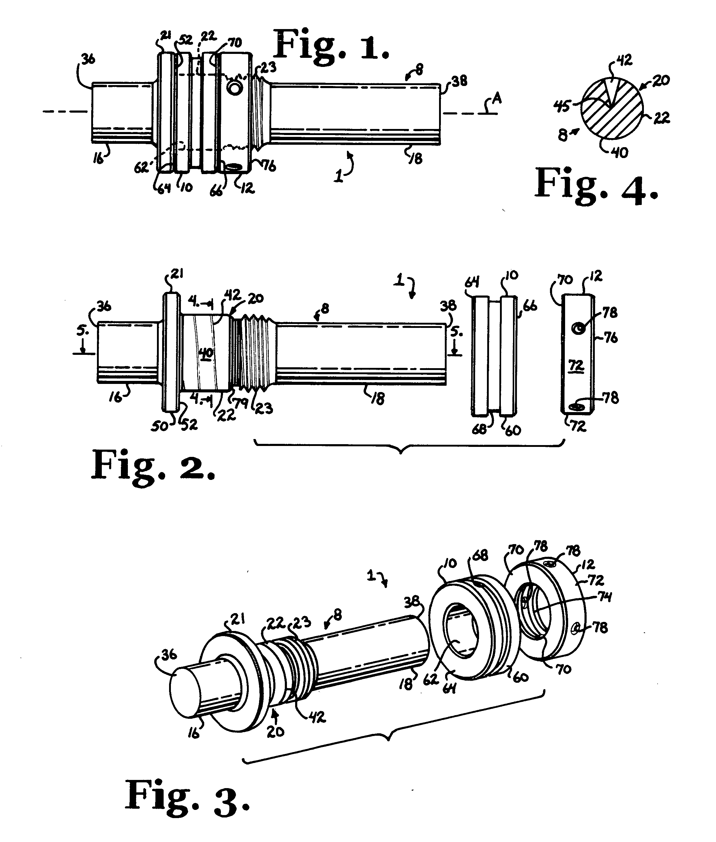 Dynamic stabilization connecting member with slitted segment and surrounding external elastomer