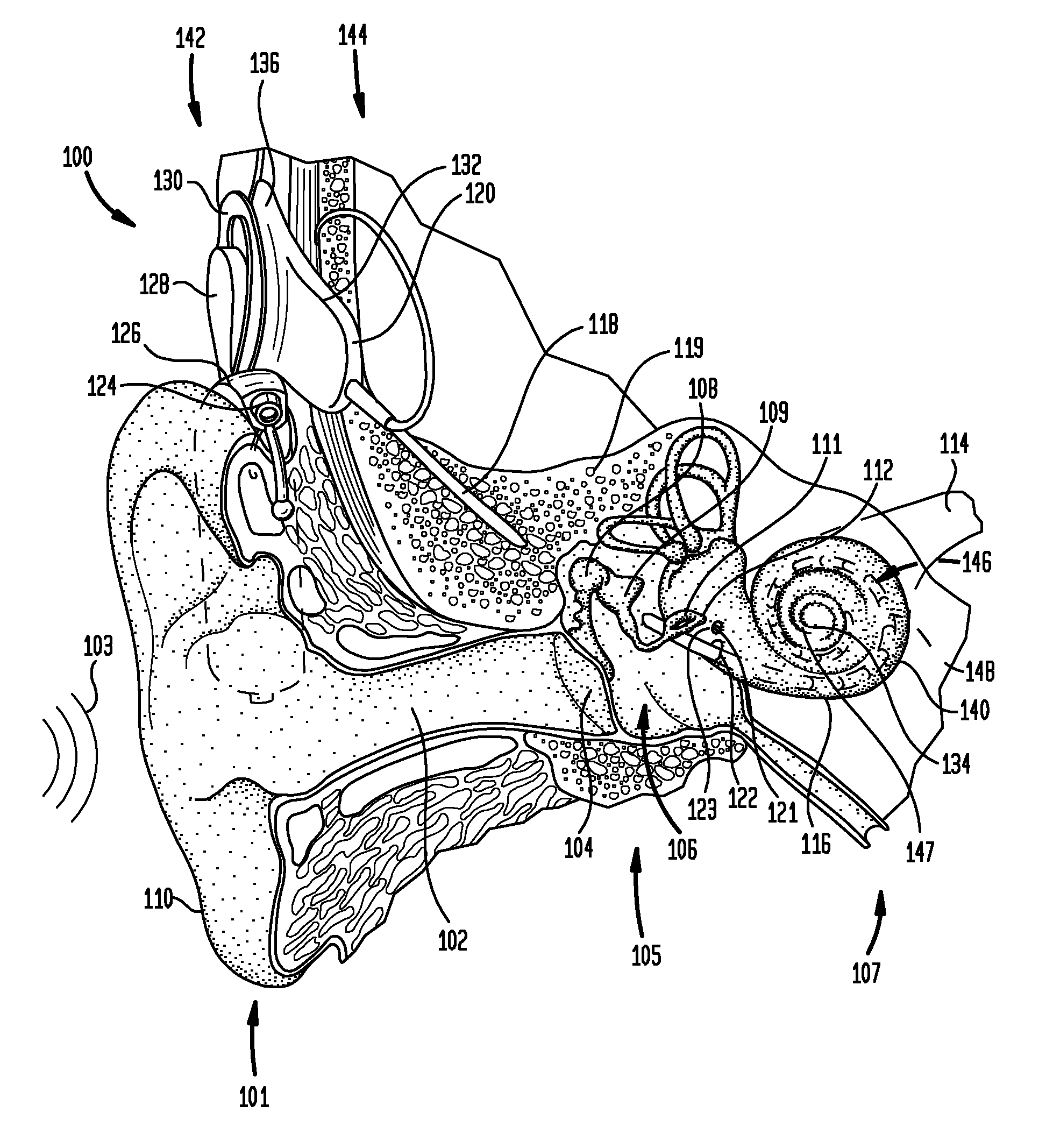 Rate matching for a stimulating medical device