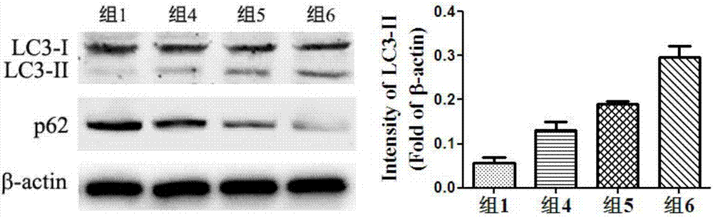 Preserving solution for maintaining activity of mesenchymal stem cells in transportation and preparation method thereof