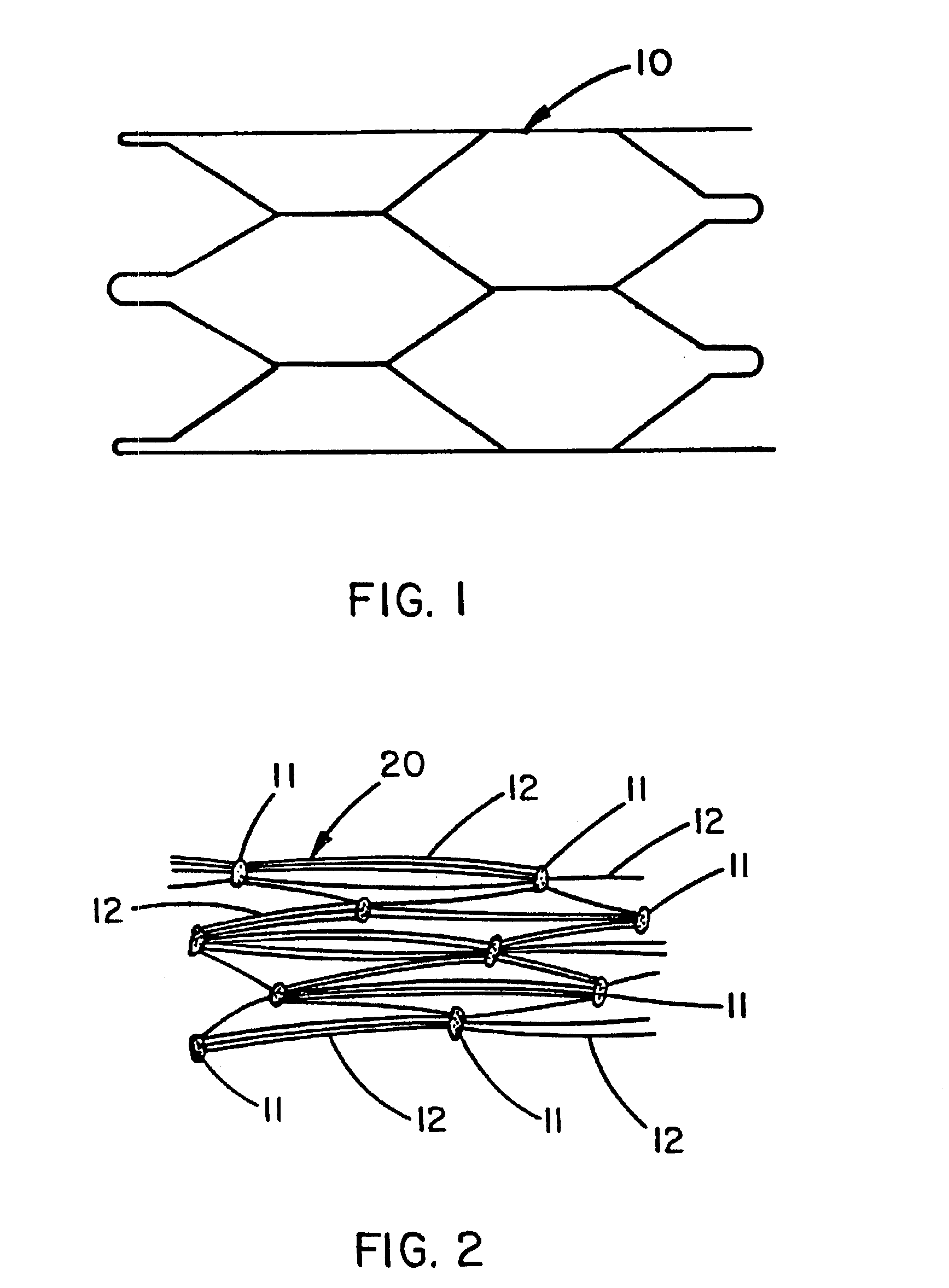 Method of making an intraluminal stent graft