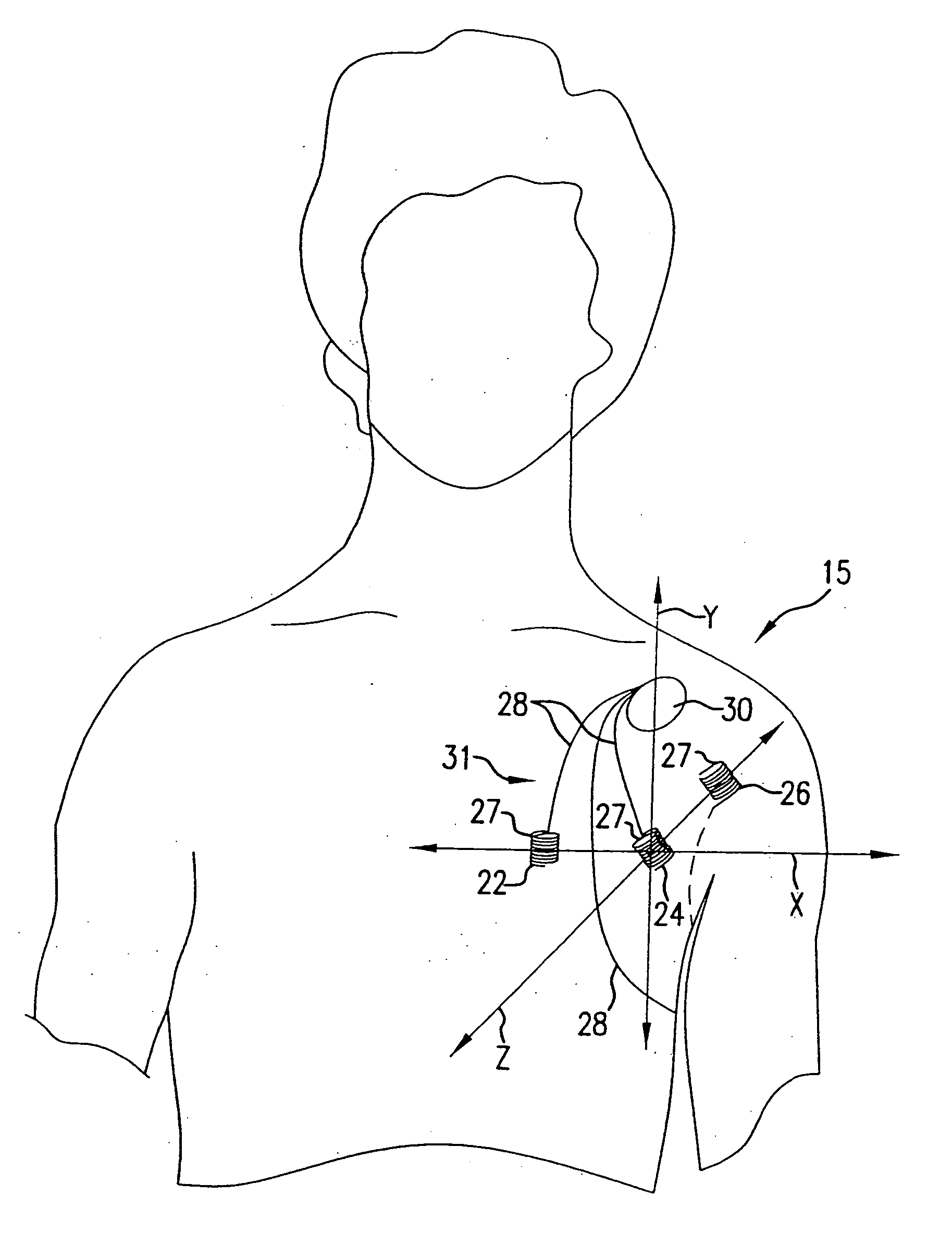 Cardiac arrest monitor and alarm system