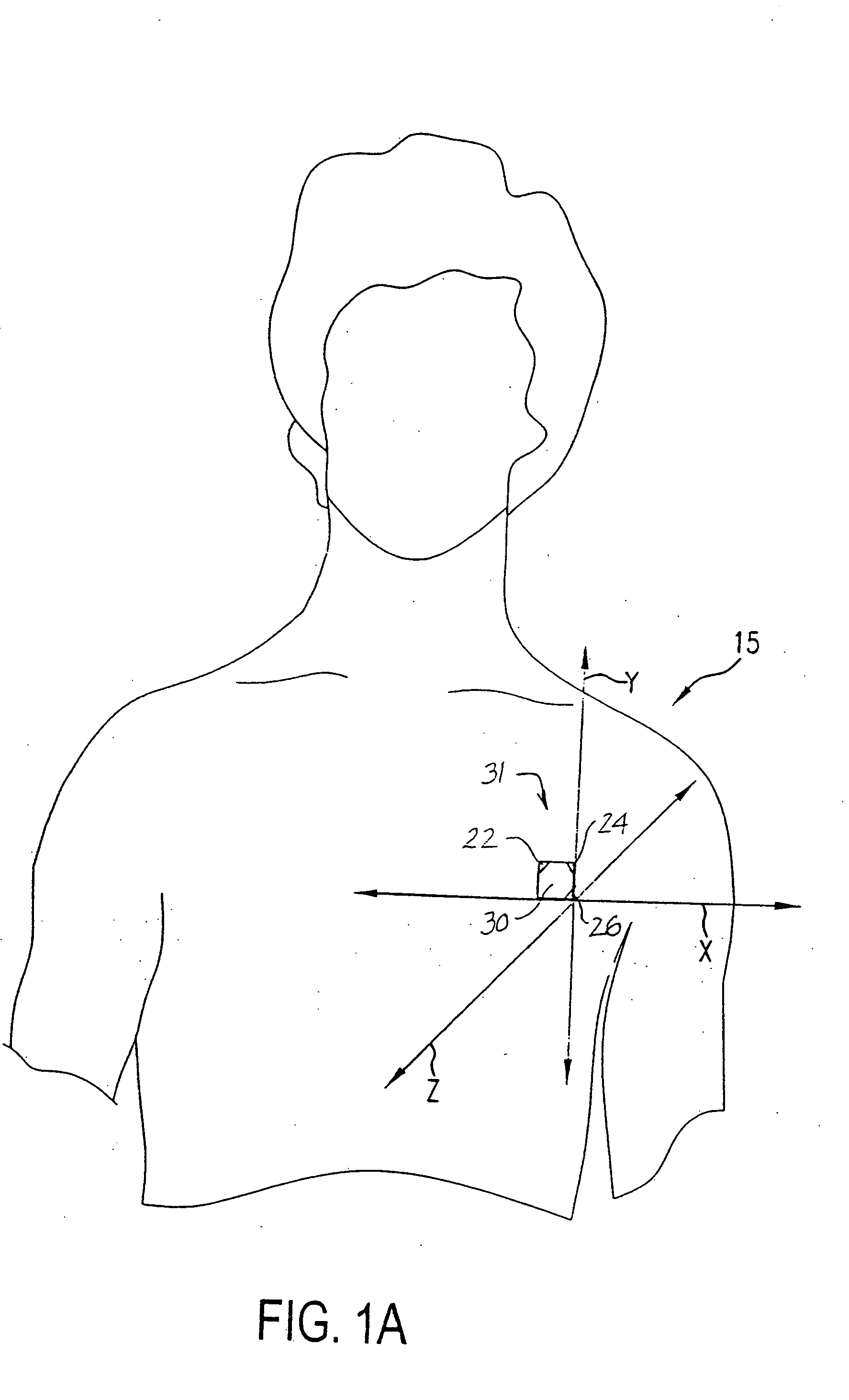 Cardiac arrest monitor and alarm system