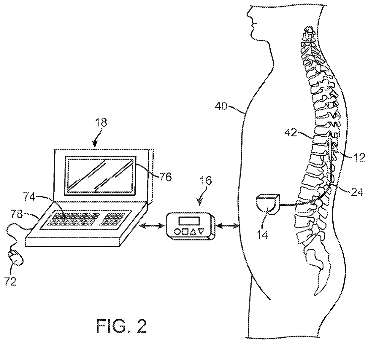 System and method to automatically incorporate lead information from medical image into programmable user interface