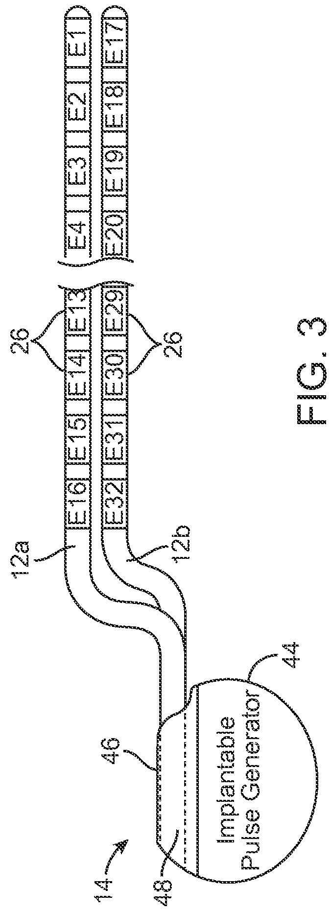 System and method to automatically incorporate lead information from medical image into programmable user interface