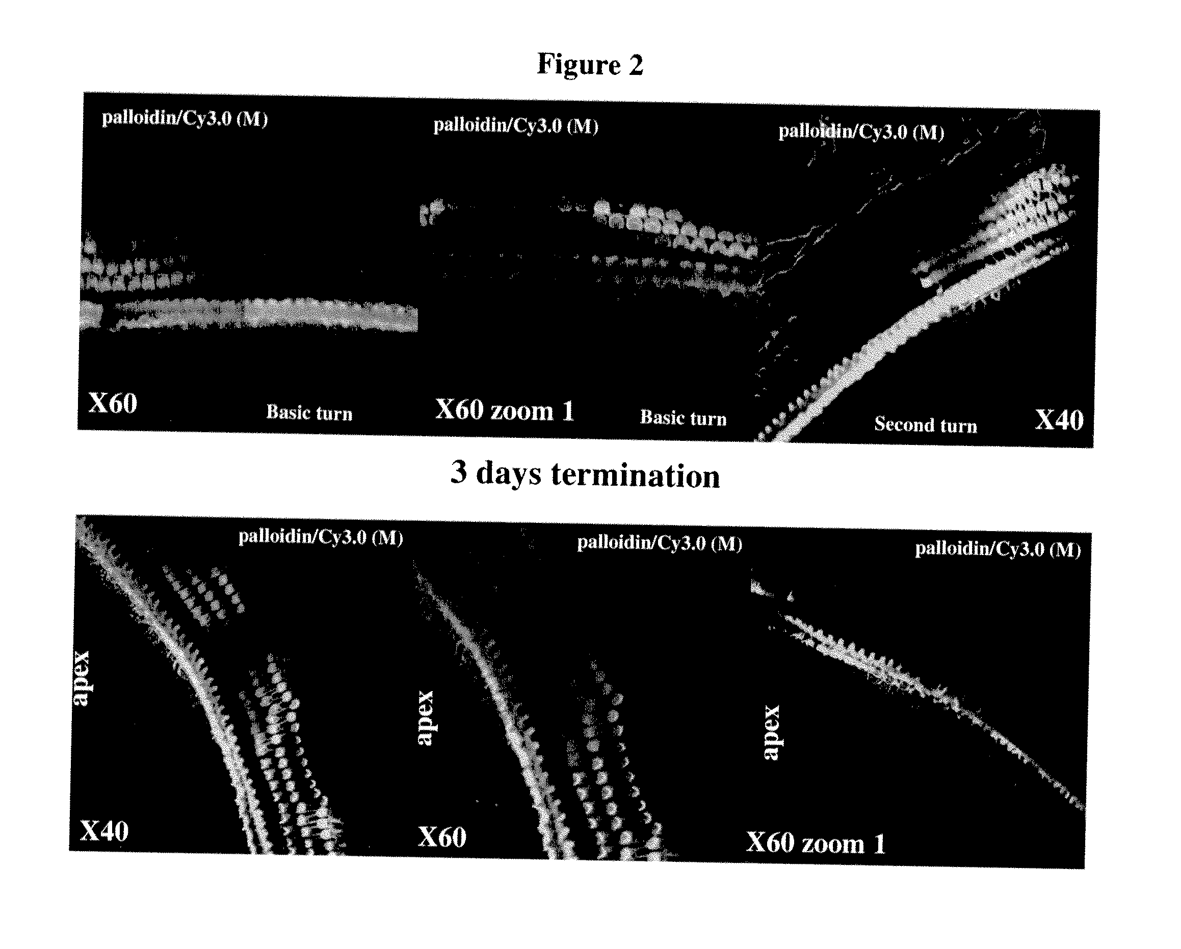 Compositions and methods for treatment of ear disorders