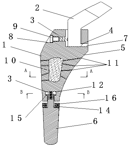 a biological hip