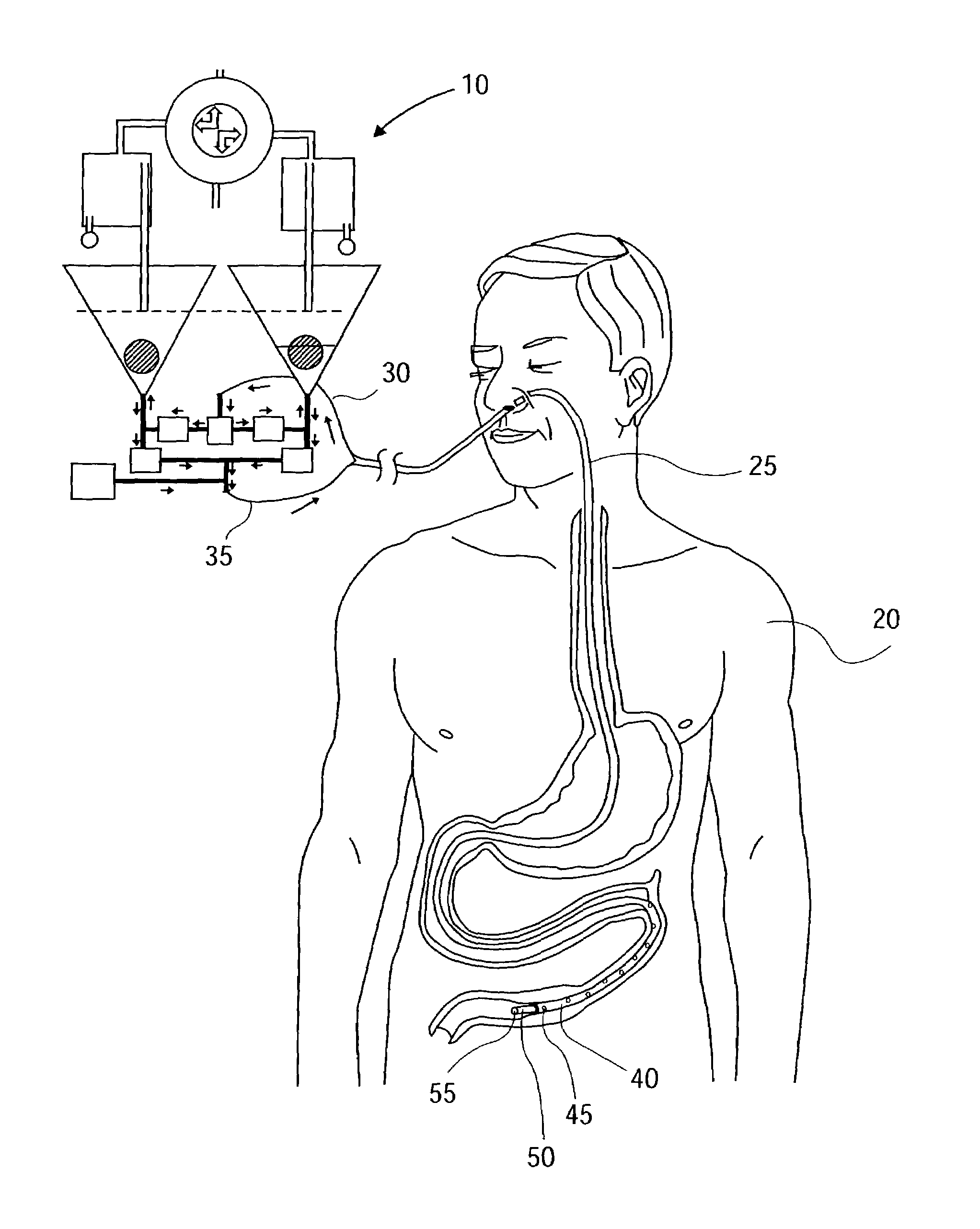 Continuous feeding and decompressing device and method