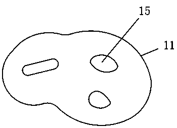 Personalized bone-imitating trabecularism metal gasket based on 3D printing technology