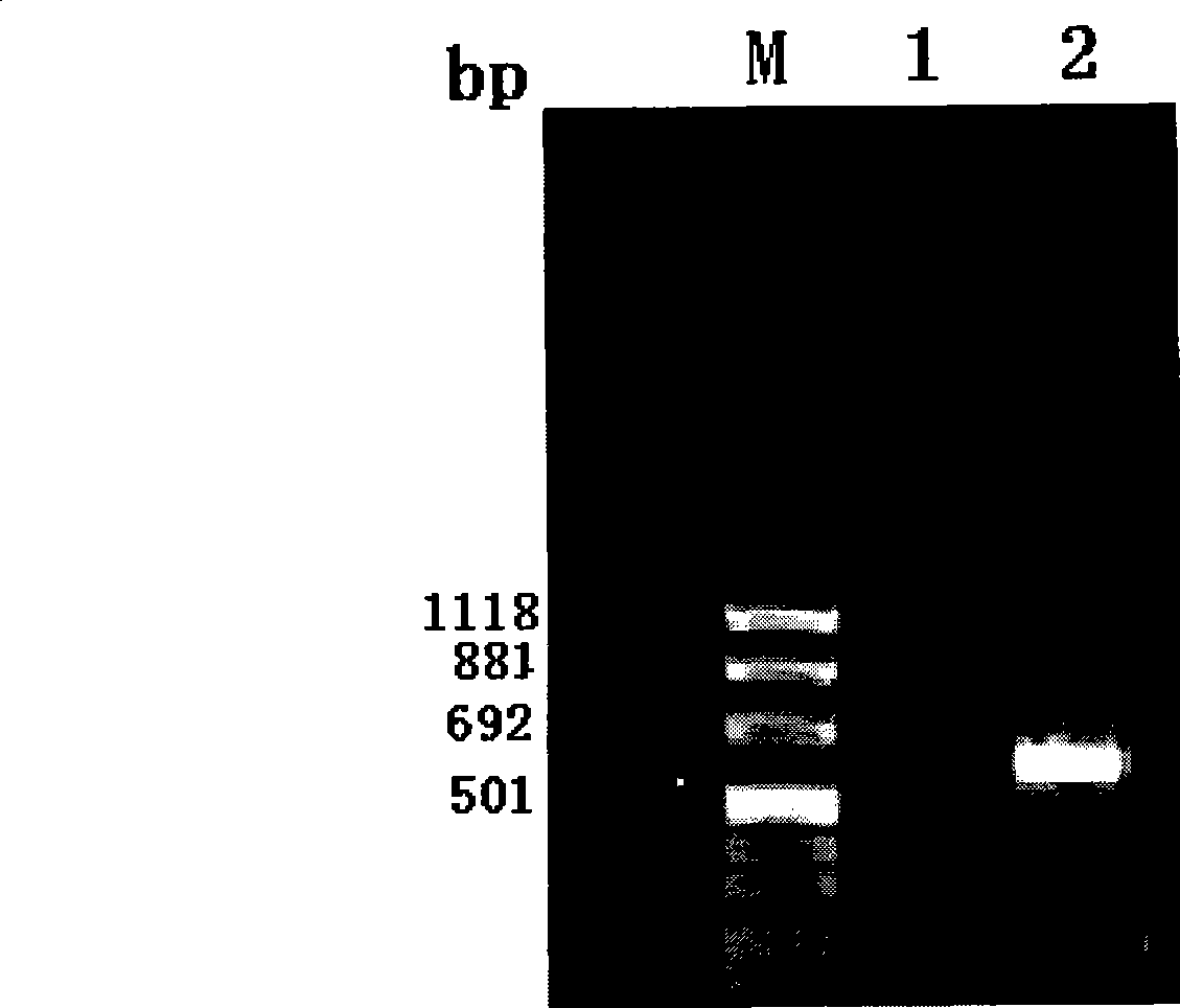 Hepatitis C virus antigen-antibody combined detection method