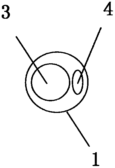 Visible ureterorenoscope negative-pressure stone-removing pressure-measuring expanding sheath assembly with marks