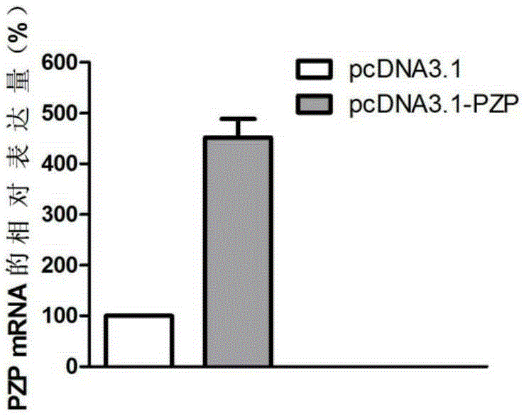 Application of PZP gene in diagnosis and treatment of biliary duct cancer