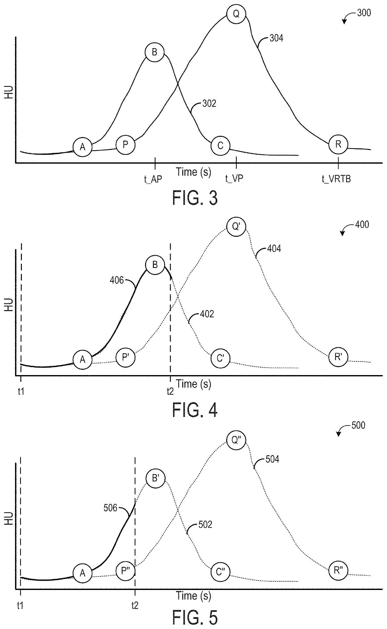 Methods and systems for an adaptive four-zone perfusion scan