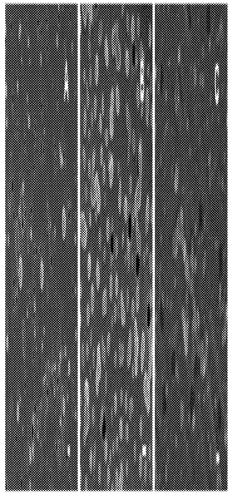 Self-assembling nanoparticles for the release of bisphosphonates in the treatment of human cancers