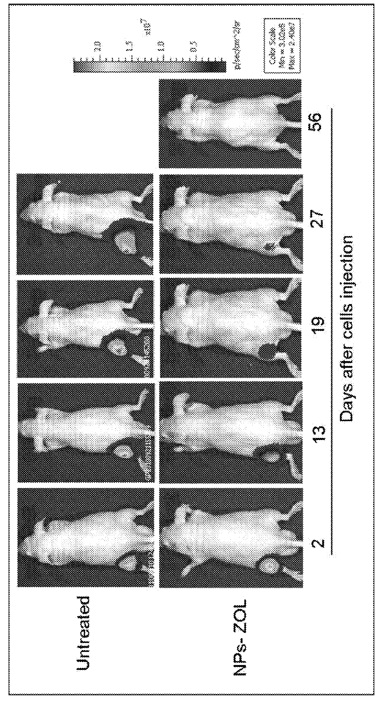 Self-assembling nanoparticles for the release of bisphosphonates in the treatment of human cancers