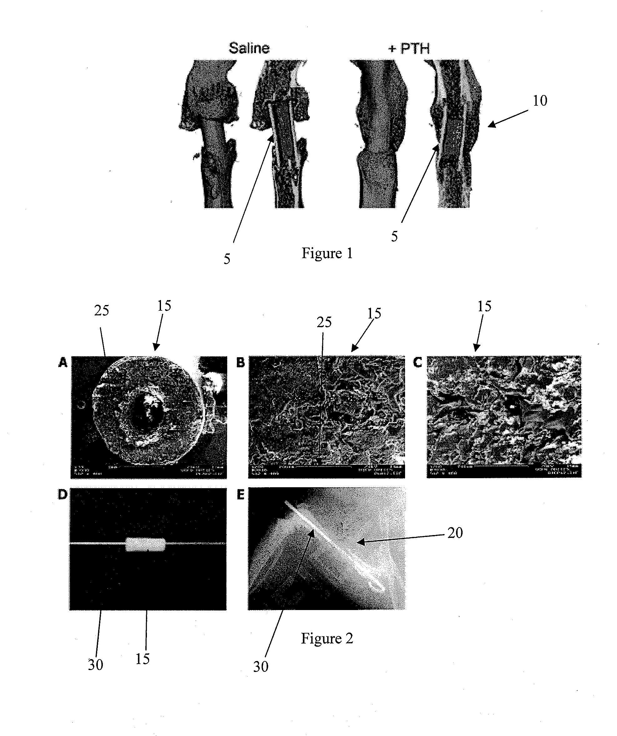 Parathyroid hormone treatment for enhanced allograft and tissue-engineered reconstruction of bone defects