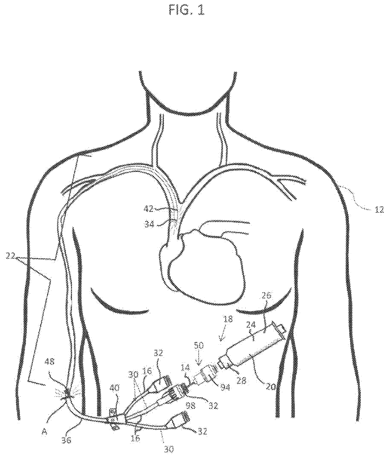 Method and apparatus for removable catheter visual light therapeutic system