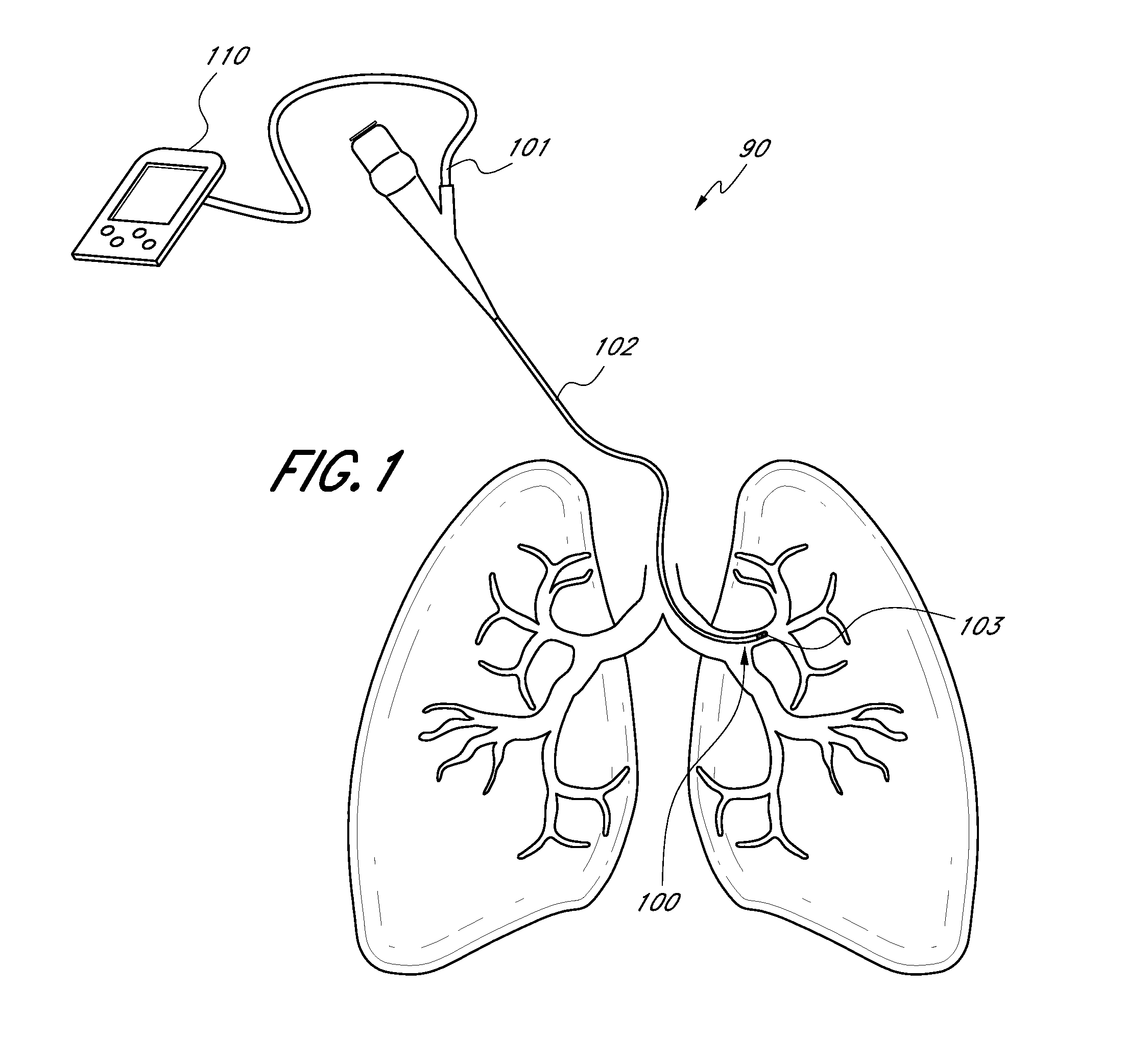 Direct lung sensor systems, methods, and apparatuses