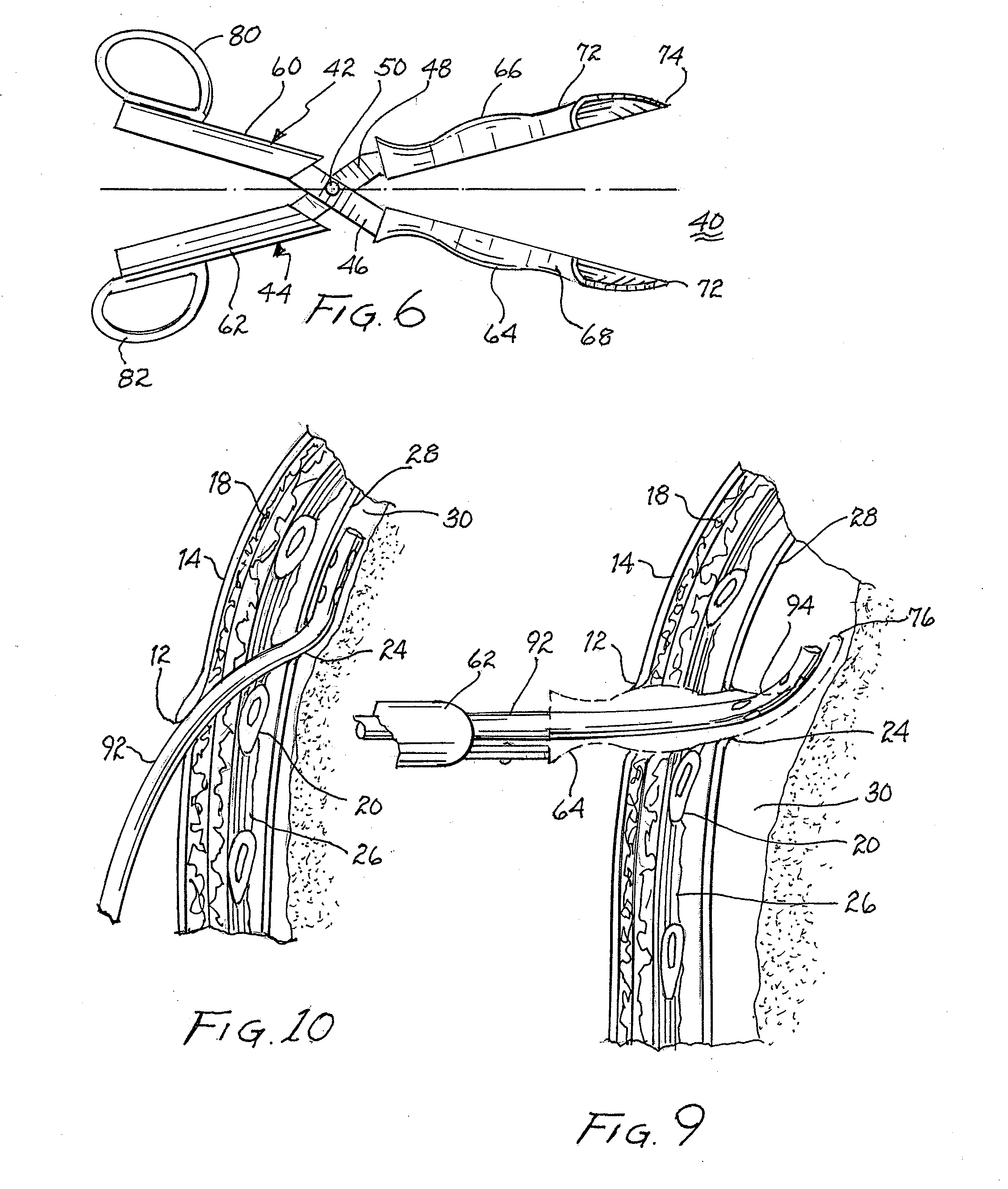 Medical instrument for inserting a chest drainage tube