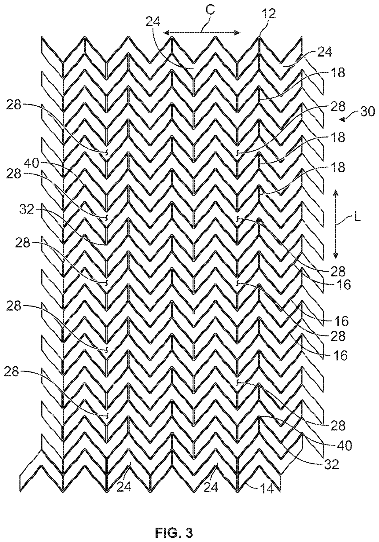 Stent and method of making same