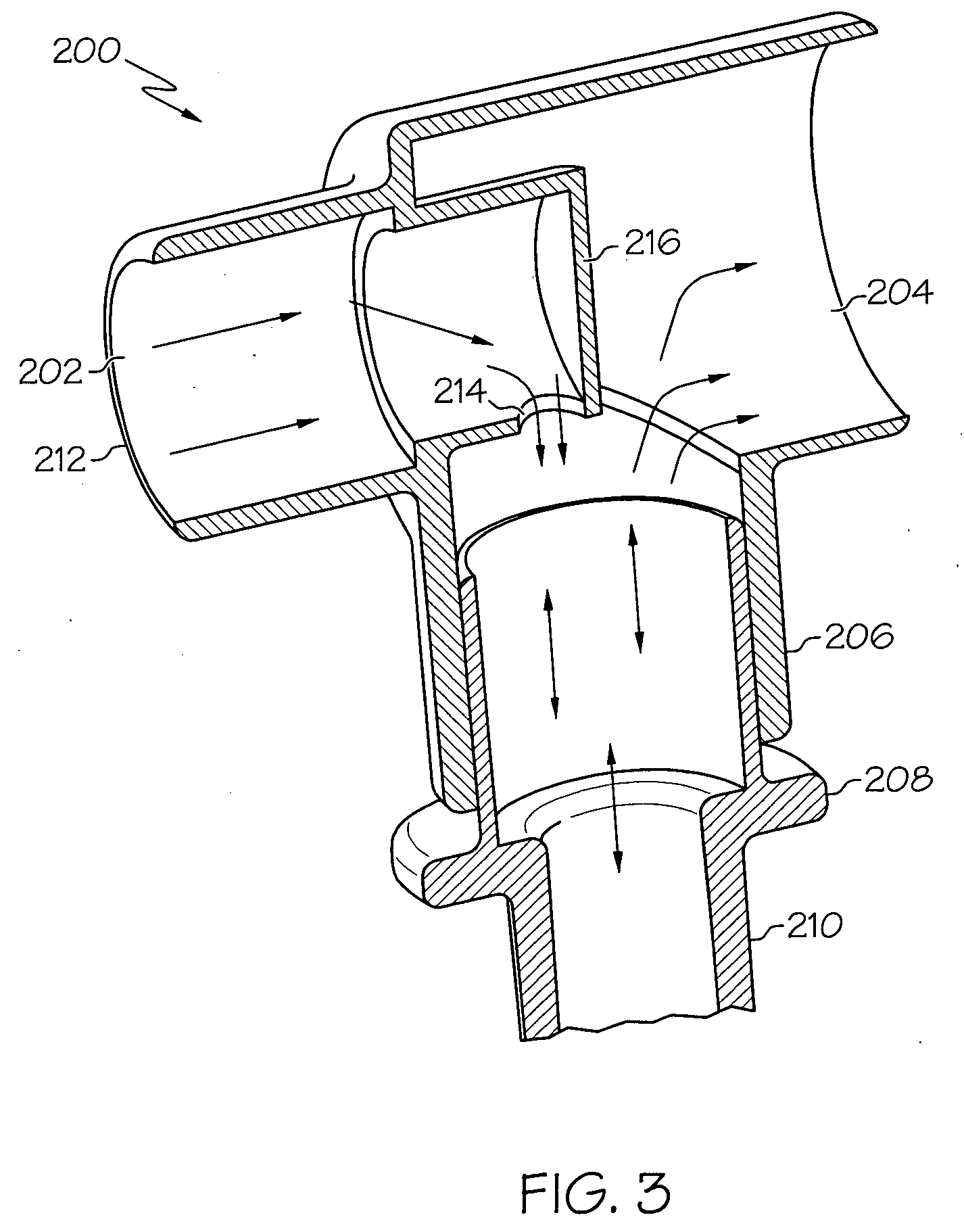 Artificial airway interfaces and methods thereof