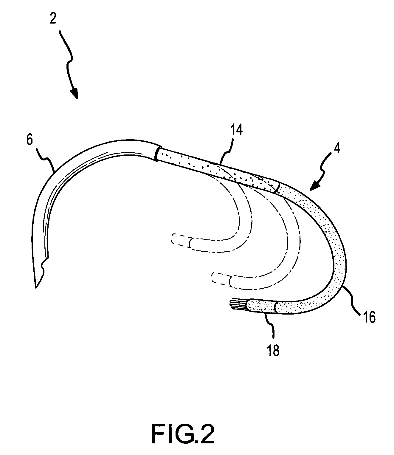 Curved ablation catheter